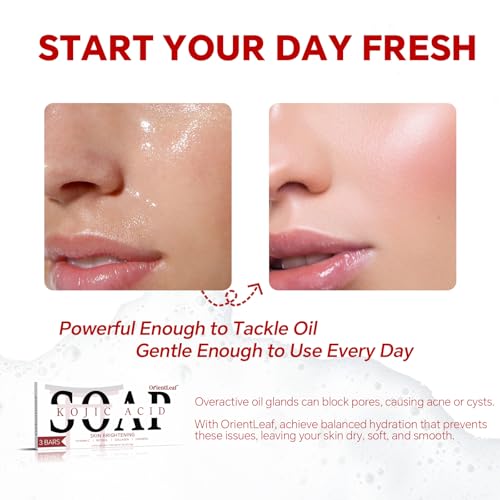 ORIENTLEAF Kojic Acid & Turmeric Soap 3-Pack – Brightening Bar for Dark Spots, Face & Body, Vitamin C, Shea Butter & Collagen