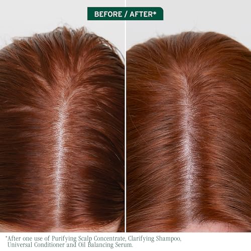 Biolage Scalp Sync Purifying Concentrate - Exfoliating & Clarifying Dry Scalp Treatment, Refreshing & Reinvigorating, Fermented Tea Blend & Glycolic Acid