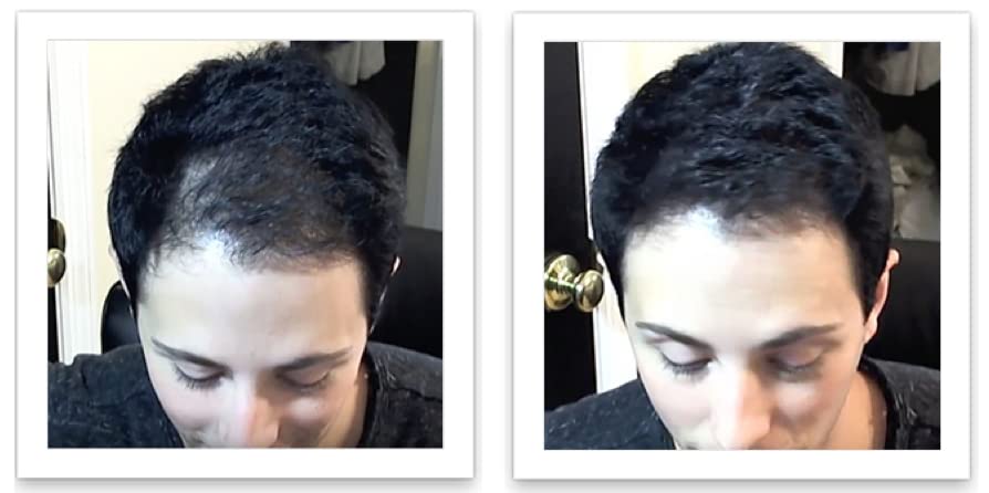 Caboki Hair Building Fiber + Built-in Spray Applicator (30-50 Days Supply). Black