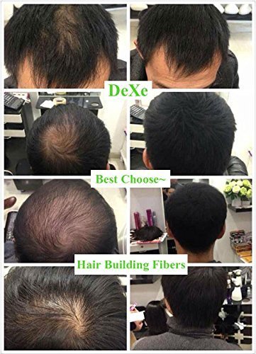 Black Colored Hair Building Fibers - Thickening Fiber for Women and Men - Hair Loss Concealer Powder for Thicker Fuller Hair - .77oz