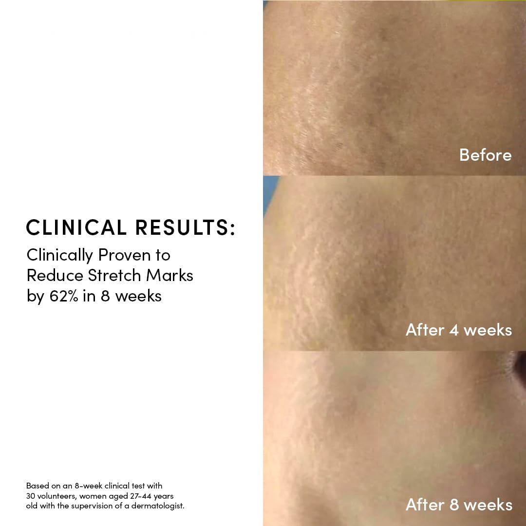 Evereden Golden Belly Serum 1.7 fl oz – Clean, Vegan, Non-Toxic Belly Oil for Pregnancy & Postpartum, Stretch Mark & Maternity Skincare