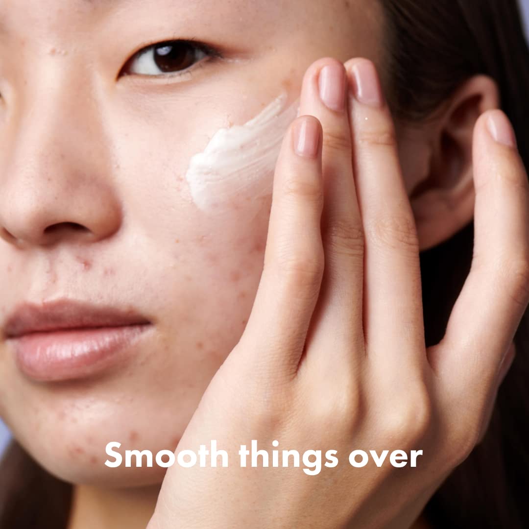 Rescue Retinol Night Cream - Smooths Texture & Fades Post-Blemish Marks, Gentle Non-Drying Retinol for Sensitive Skin, 30ml