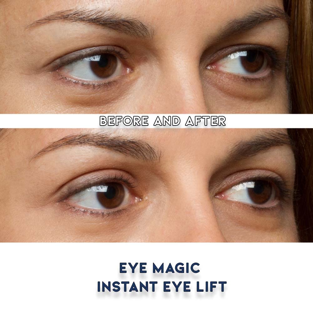 Eye Magic Premium Eye Lift Strips for Droopy or Hooded Eyelids, Instant Non-Surgical Tape, Hypoallergenic, Transparent, 80ct S/M