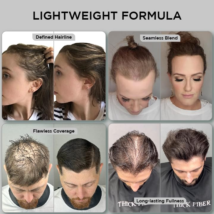 THICK FIBER Hair Fibers for Thinning Hair & Bald spots (DARK BROWN) - 25g Bottle - Conceals Hair Loss in Seconds - Hair Powder for Women & Men