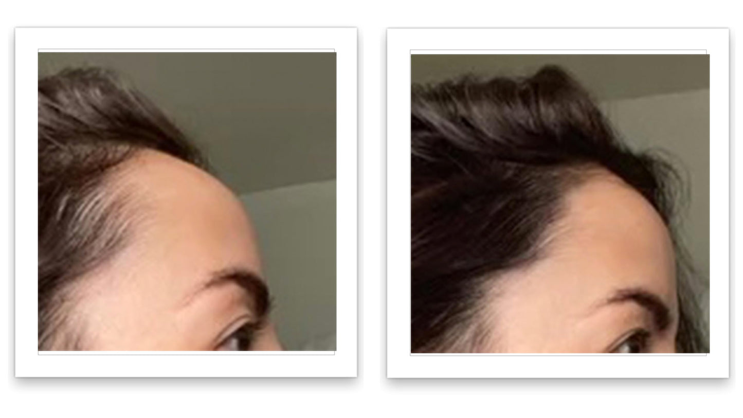 Caboki 10X Volumizing Hair Powder for Thinning Hair: Root Touch Up for Men and Women, Fill in Hairline & Edges, Cover Bald Spots. TALC-Free, Dark Gray