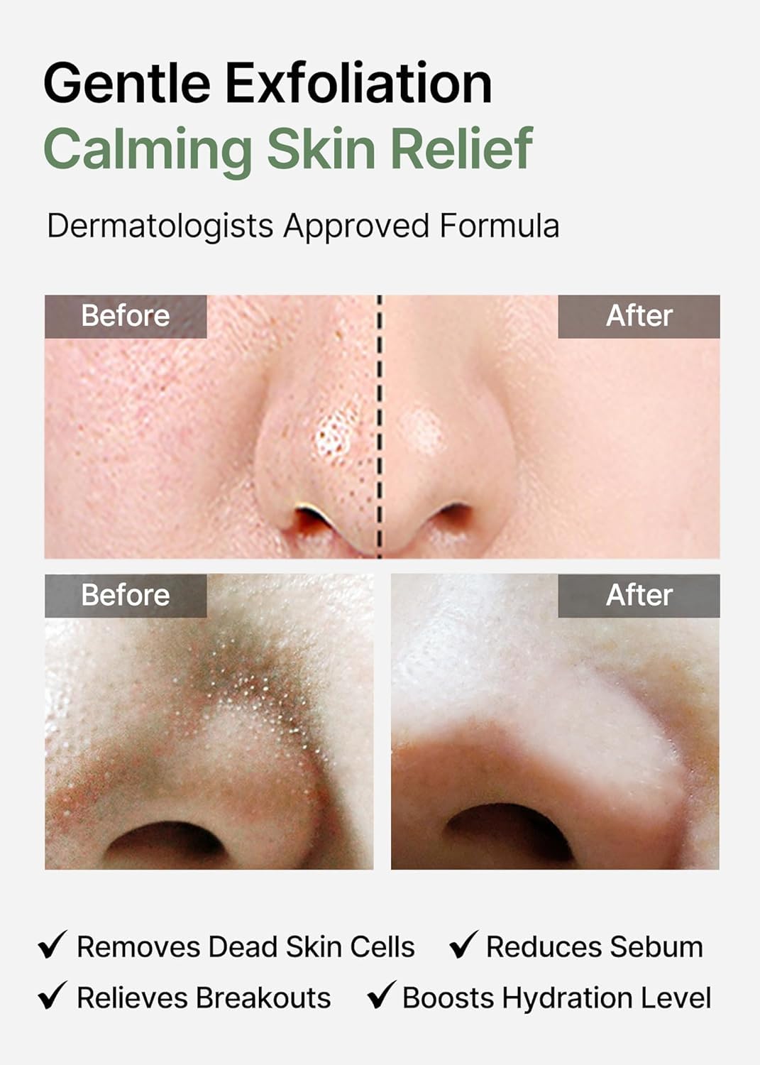 Celimax Ji.Woo.Gae Heartleaf BHA Peeling Pads – Exfoliating Toner Pads with Heartleaf Extract, Hydrating & Acne-Fighting, 60 Pads