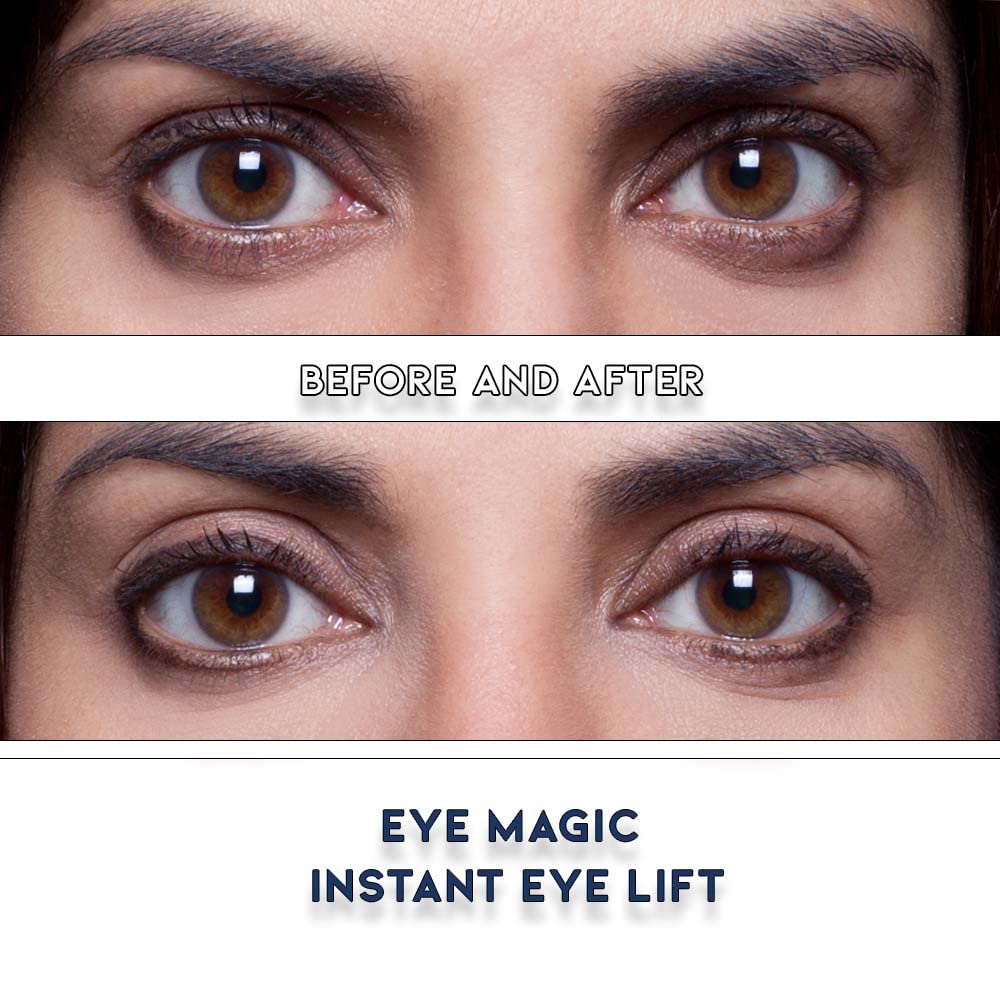 Eye Magic Premium Eye Lift Strips for Droopy or Hooded Eyelids, Instant Non-Surgical Tape, Hypoallergenic, Transparent, 80ct S/M