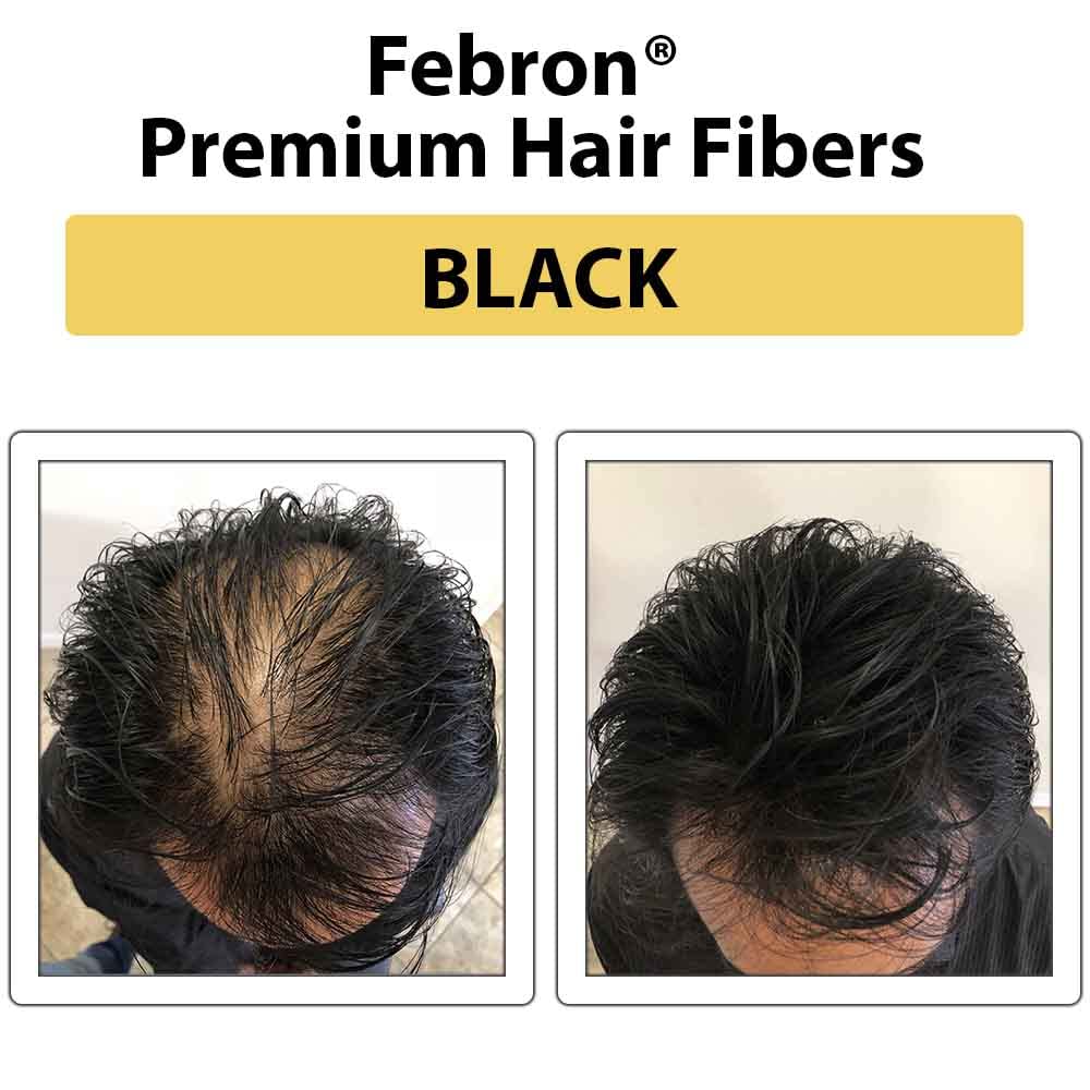 FEBRON Hair Fibers for Thinning Hair Black 30g – Hair Loss Concealer for Men & Women – Natural, Undetectable Hair Powder Filler for Bald Spots