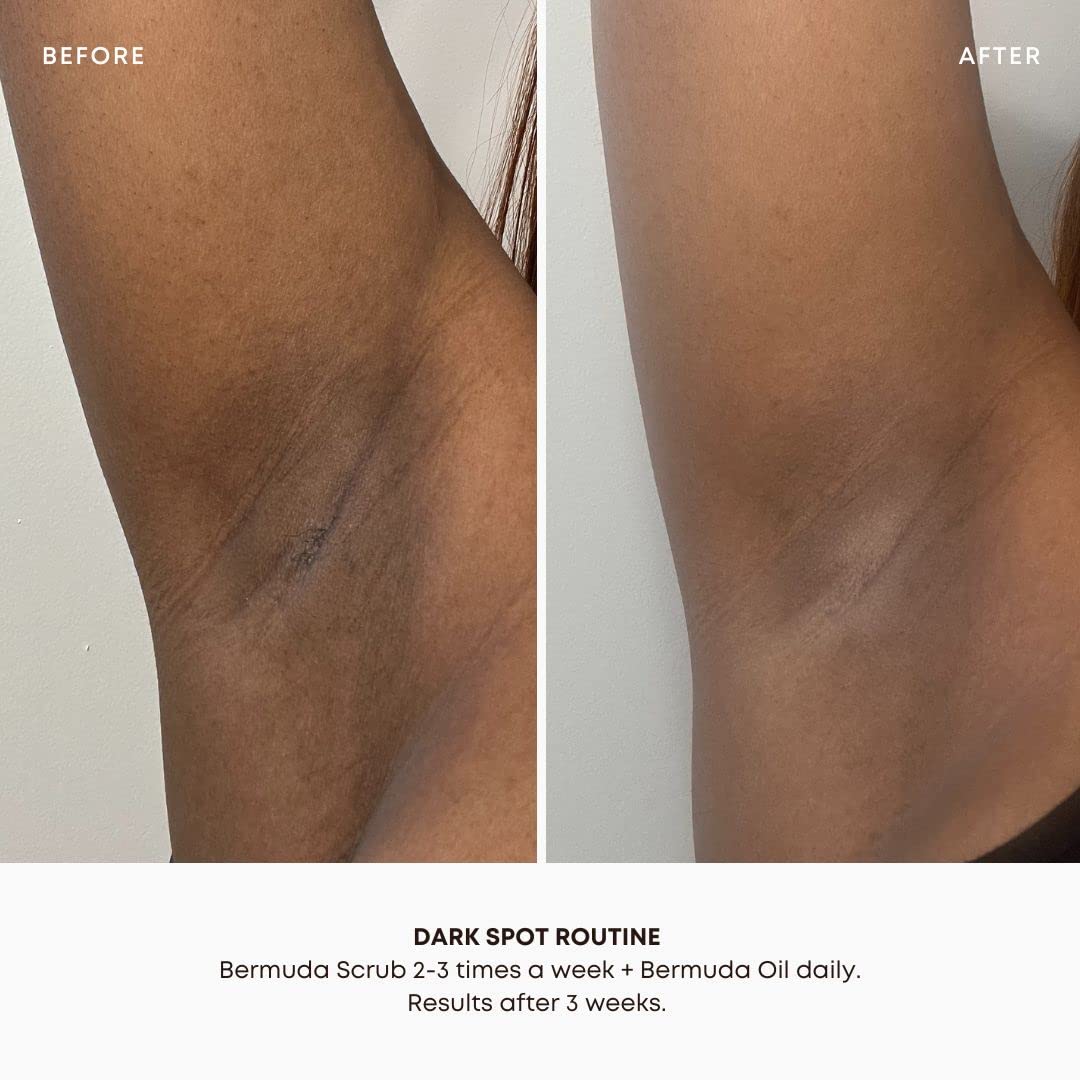 Bushbalm Dark Spots and Ingrown Hair 2 Step Routine - Rejuvenate and Nourish - Ingrown Hair Oil (30 ml) and Exfoliating Scrub (236 ml) - Bermuda