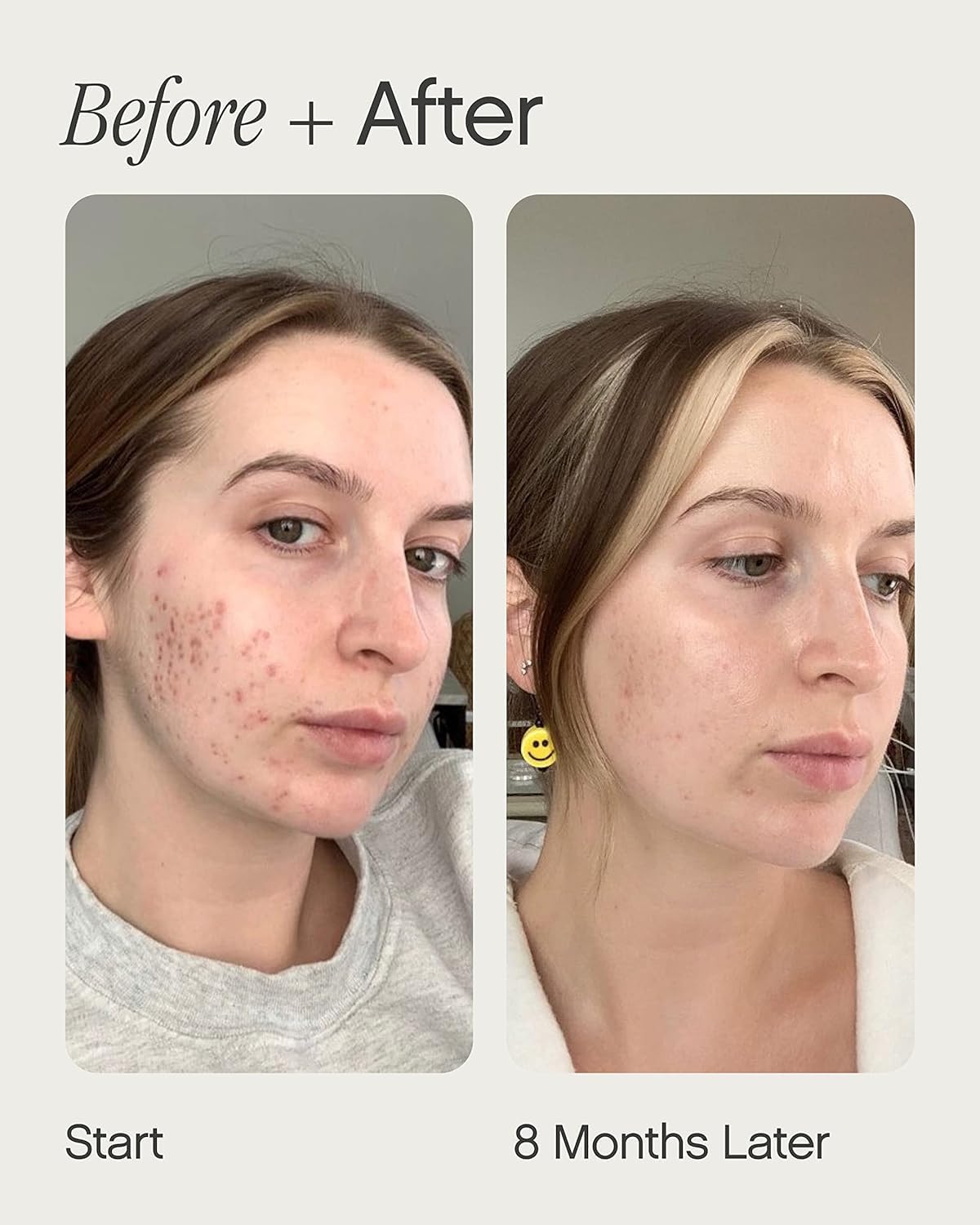 Topicals Faded Brightening & Clearing Serum, Reduces Discoloration, Dark Spots & Scars, Kojic Acid & Niacinamide, Vegan, 0.5 Fl Oz