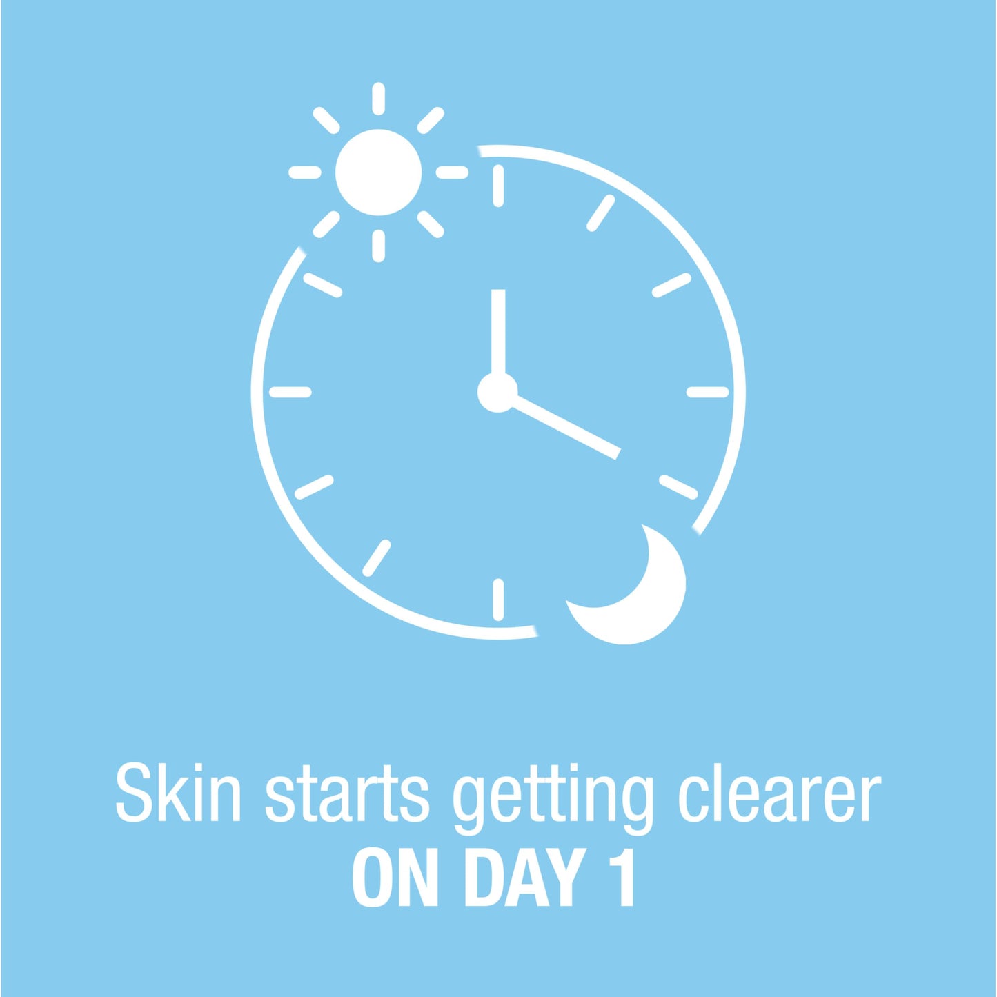 Neutrogena On-The-Spot Acne Treatment Cream, 2.5% Benzoyl Peroxide, Clinically Proven, Gentle Formula for Acne-Prone Skin, 0.75 oz