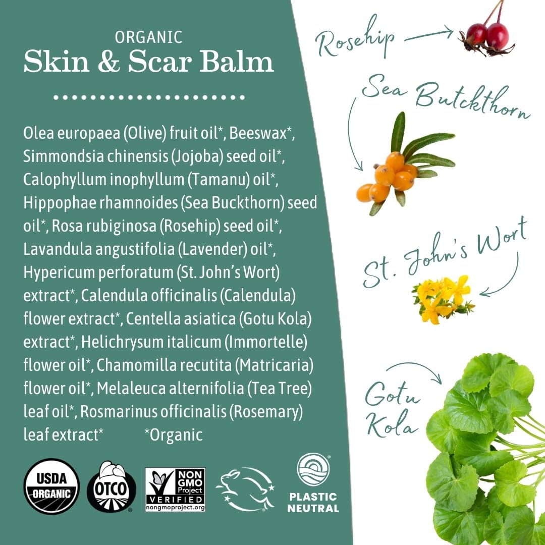 Earth Mama Organic Skin & Scar Balm 2-Pack – C-Section & Stretch Mark Recovery Cream with Jojoba, Tamanu & Gotu Kola Oils