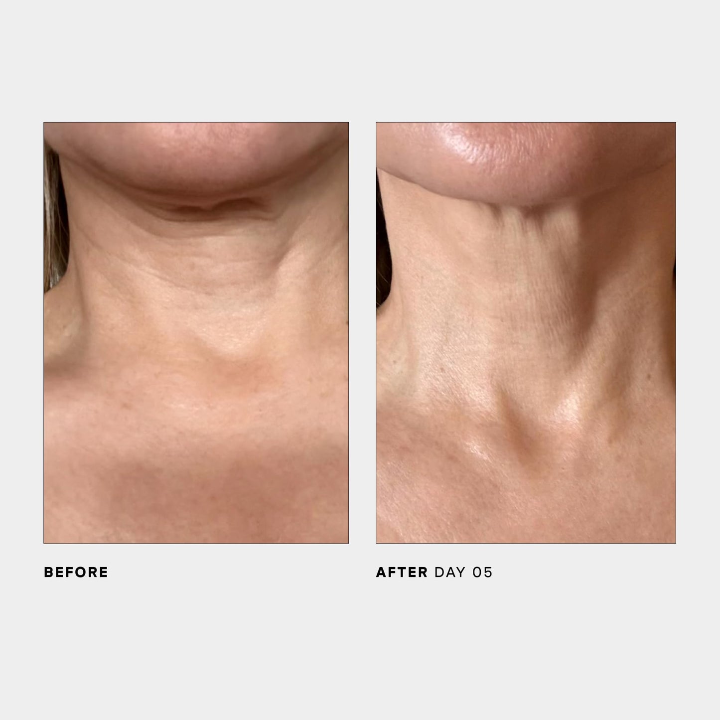 U Beauty The SCULPT Neck + Décolleté Concentrate