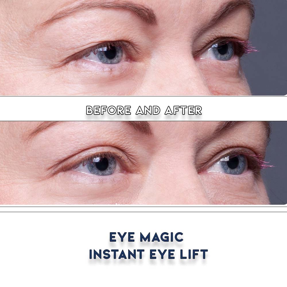 Eye Magic Premium Eye Lift Strips for Droopy or Hooded Eyelids, Instant Non-Surgical Tape, Hypoallergenic, Transparent, 80ct S/M