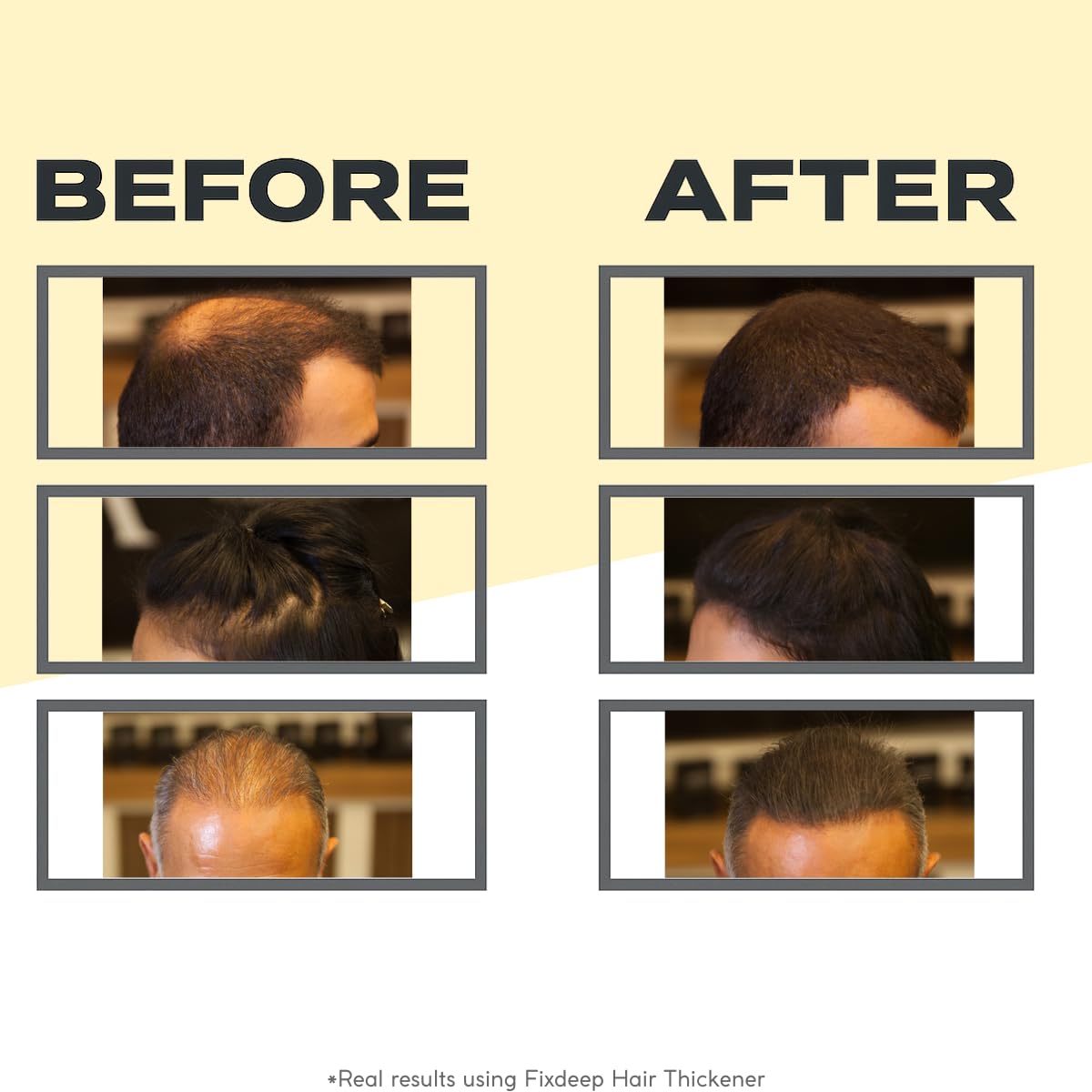 Fixdeep Hair Building Fibers for Thinning Hair (Black) | Waterproof, Sweat-Resistant | Instantly Fuller Hair in 30 Sec | Covers Bald Spots & Gray Roots, 14g