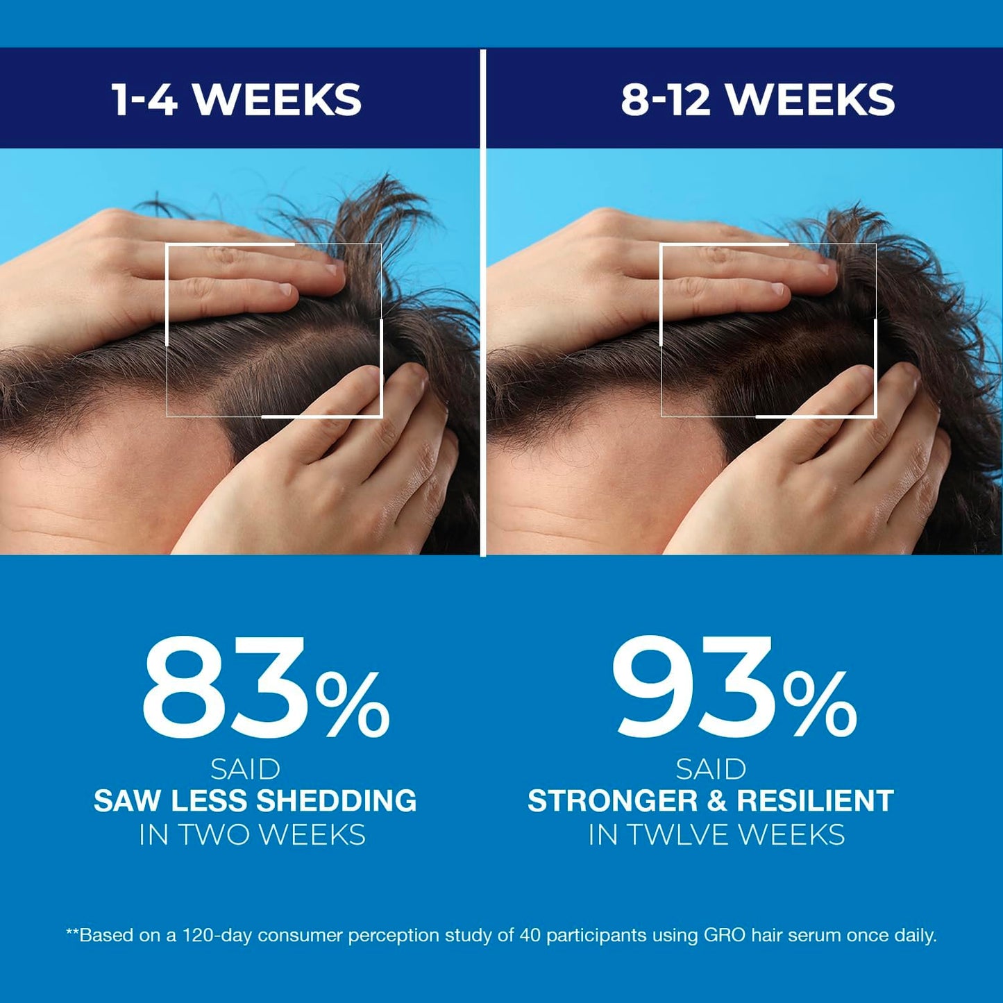 Biotin Hair Growth Shampoo for Men: Root Activator for Thinning Hair, Thickening & Strengthening Formula-DHT Blocker with Tea Tree Oil and Caffeine