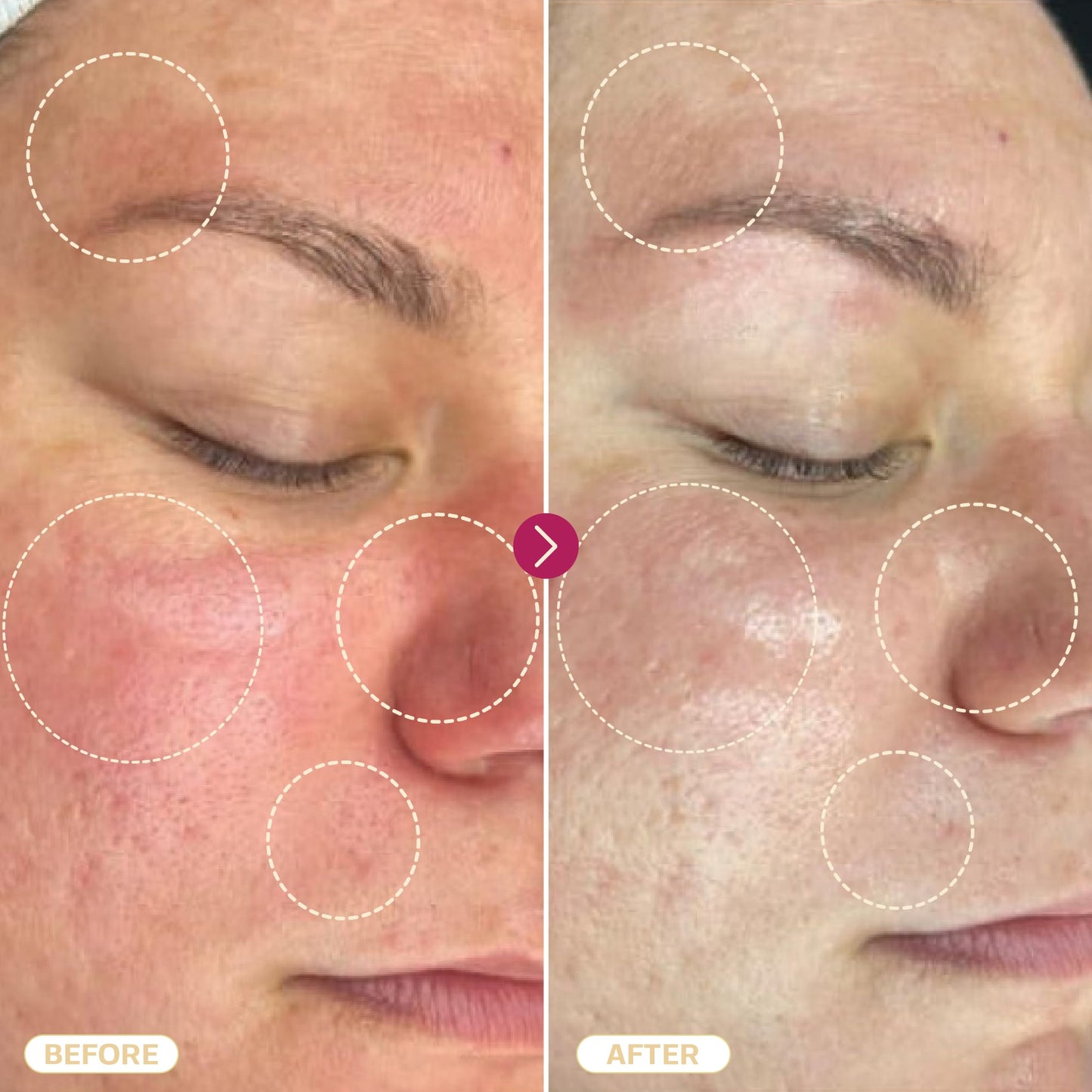 BASE LABORATORIES Hypochlorous Acid Spray for Face & Skin, 8 oz – Daily Repair for Sensitive Skin, Redness, Irritations, Acne & Eczema