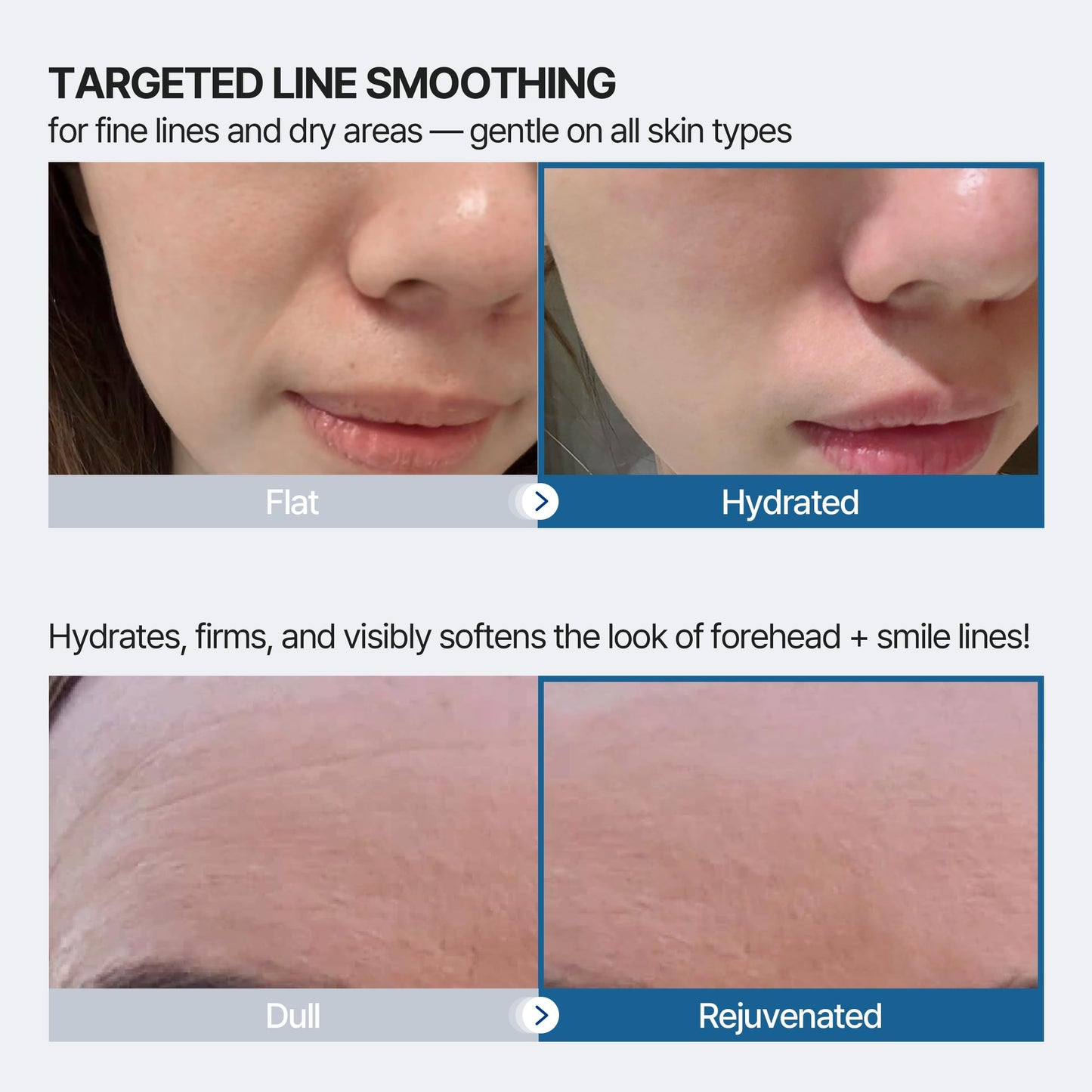 Honeydew Labs Anti-Wrinkle Patches for Forehead & Smile Lines with Retinol, Collagen & Peptides – 36PCS Overnight Face Smoothing