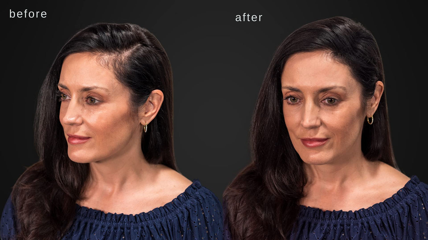 LUXE Hair Building Fibers for Thinning Hair – Dark Brown – Thickening Fibers, Hypoallergenic, Dermatologist Tested, 2+ Month Supply