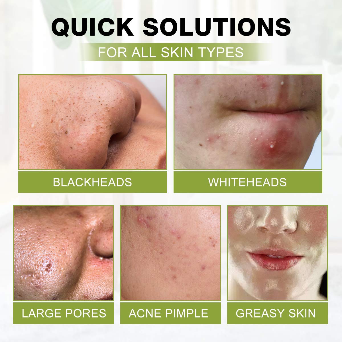 SHVYOG Blackhead Peel Off Mask 3-in-1 with Brush & Tea Tree Oil Serum, Charcoal Deep Cleansing for Pores, Oil & Dirt, 100g+30ml