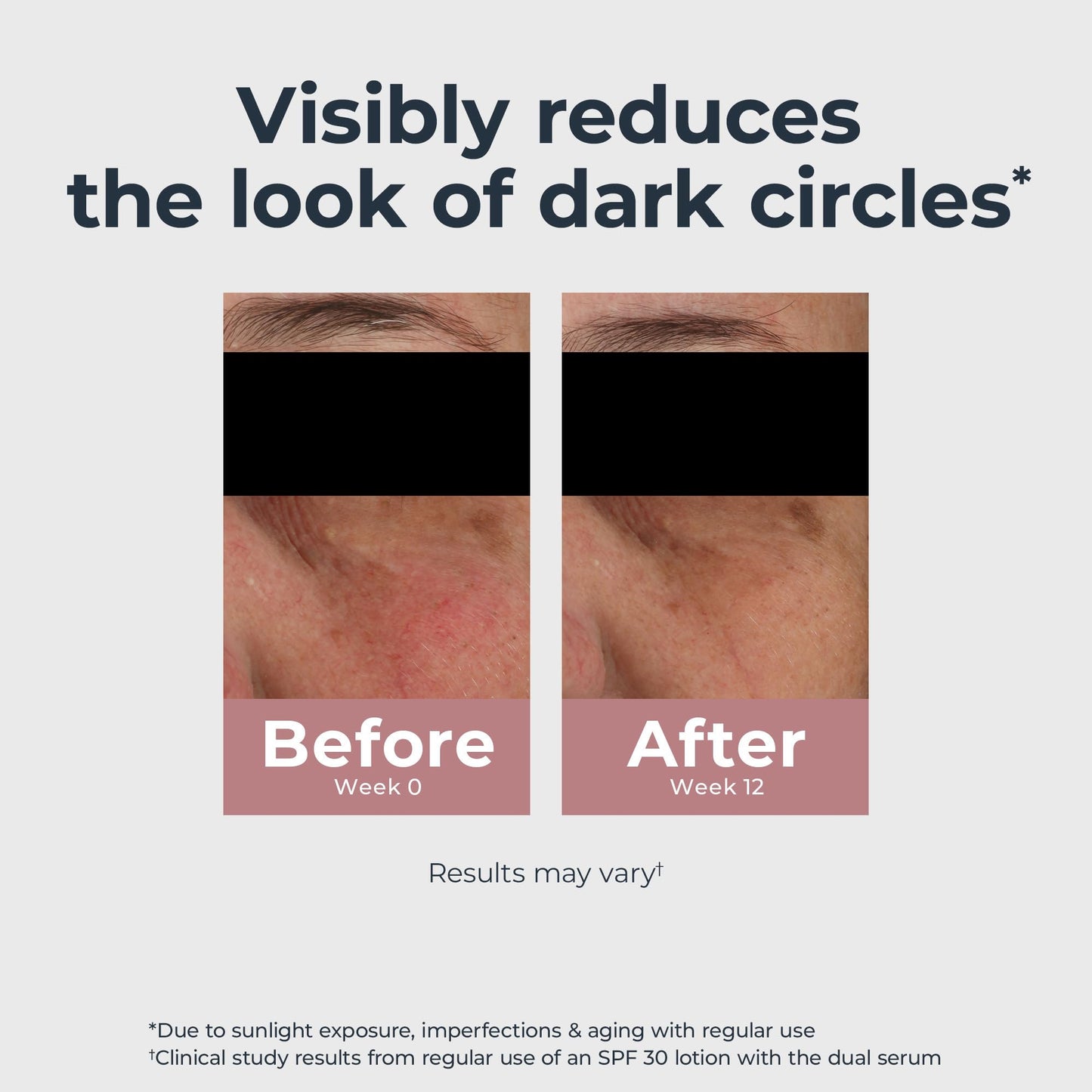 Eucerin Radiant Tone Eye Cream – Dark Circle Corrector with Thiamidol & Hyaluronic Acid, Brightens Eyes & Reduces Puffiness, 0.5 oz