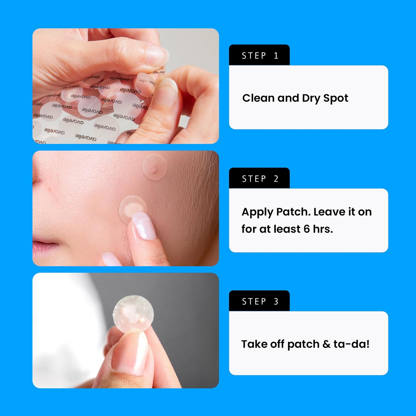 AVARELLE Acne Cover Patches with Tea Tree Oil – Korean Hydrocolloid Zit Patches for Face, Vegan & Cruelty-Free, HSA Eligible