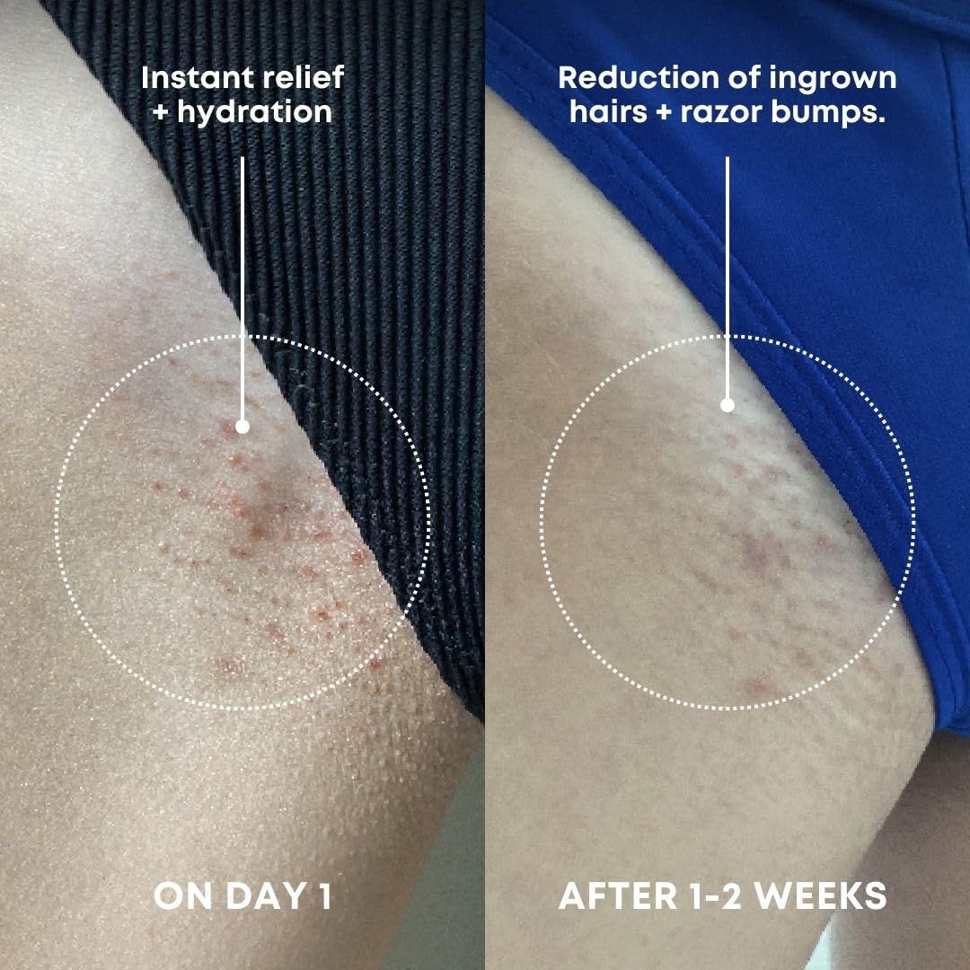 Bushbalm Ingrown Hair Exfoliating Scrub – Pre-Shave Sugar Scrub for Razor Bumps, Dry & Sensitive Skin, Soothing Buffing Treatment, 236ml