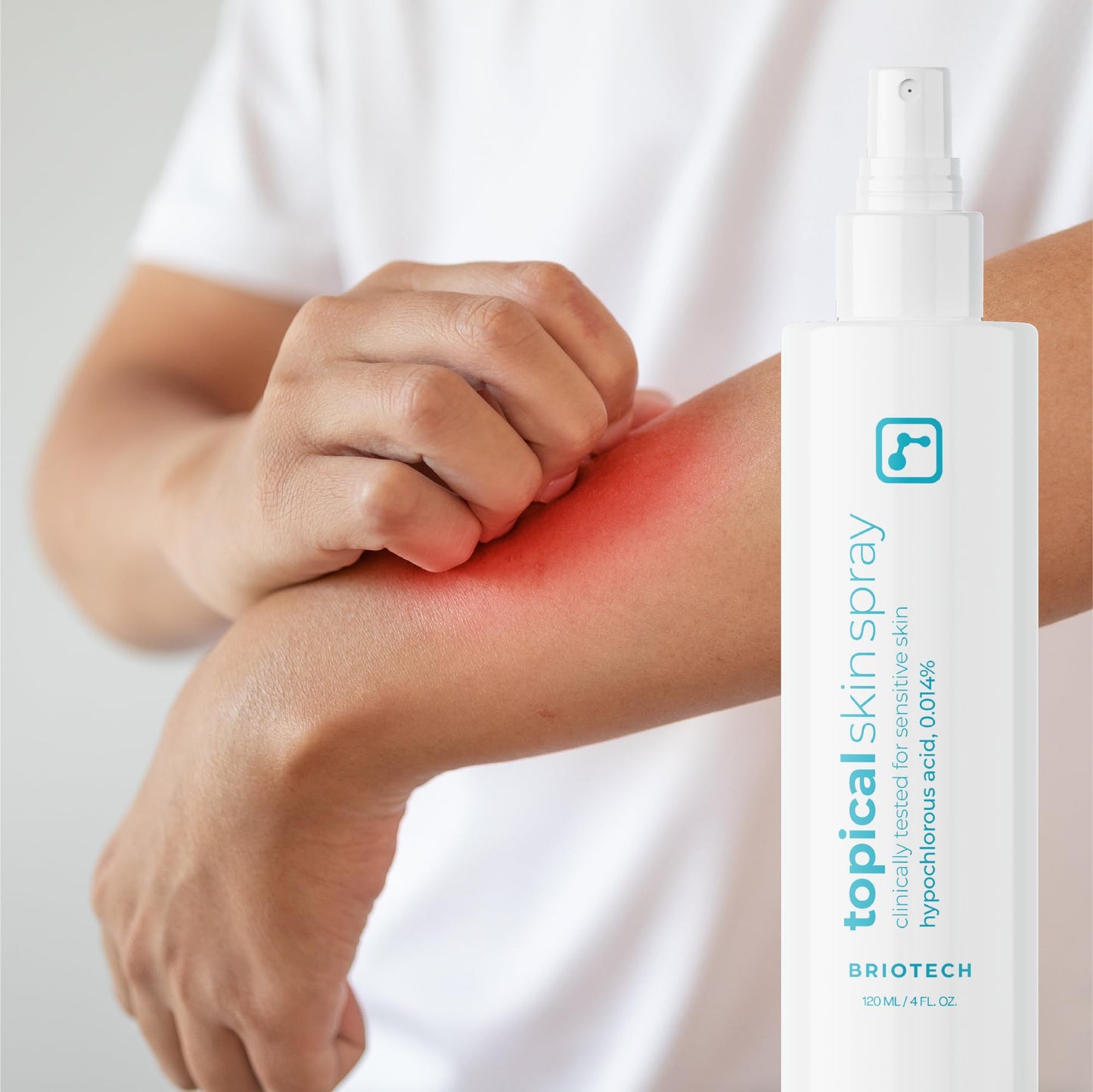 BRIOTECH Hypochlorous Acid Skin Spray – Soothes Redness, Irritation & Sensitive Skin, Facial & Full Body Mist, Foot & Scalp Relief, 8 oz