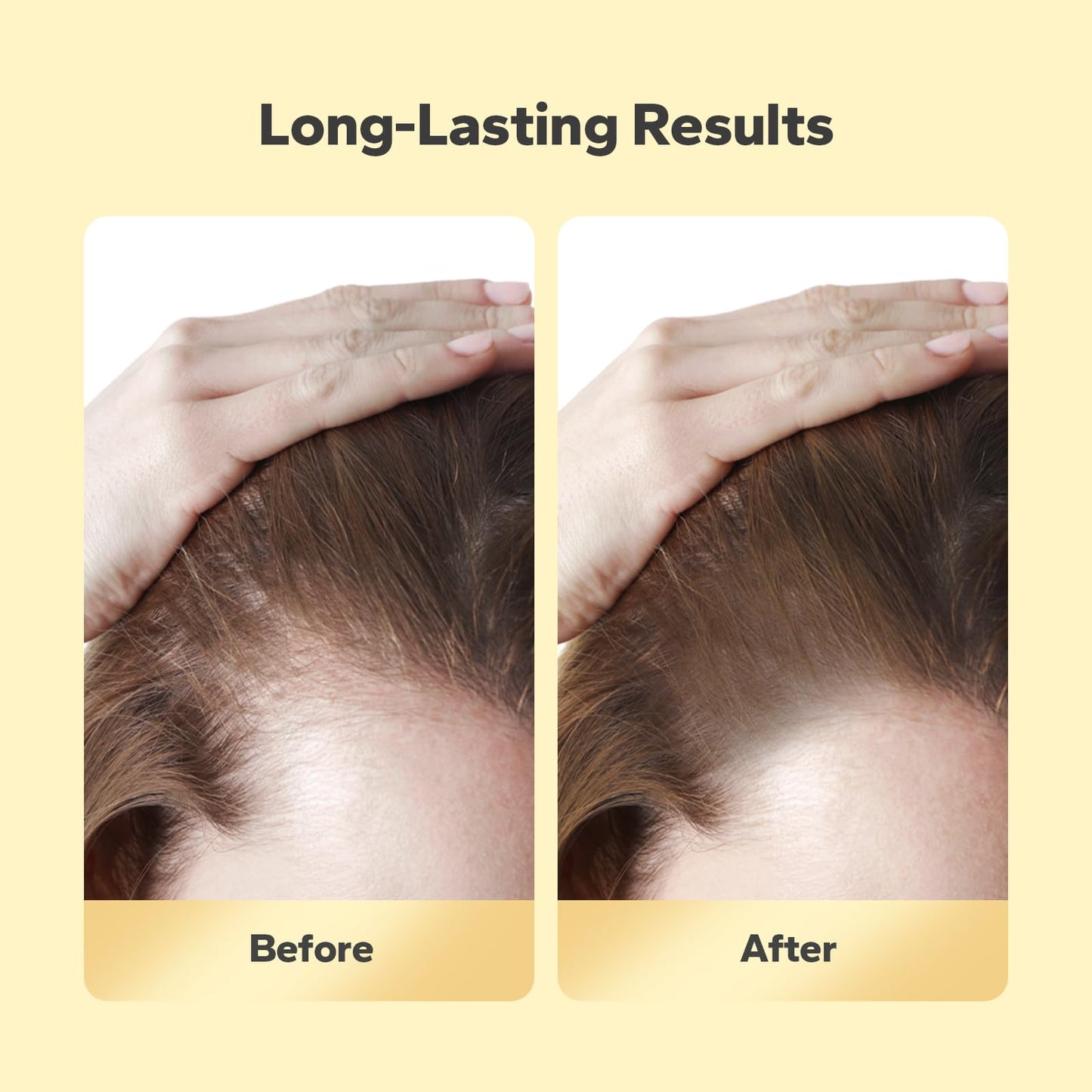 StyleShark Hairline Powder - Stain-Proof Root Touch-Up for Thinning Hair, Sweatproof Color for Women and Men (Dark Brown)