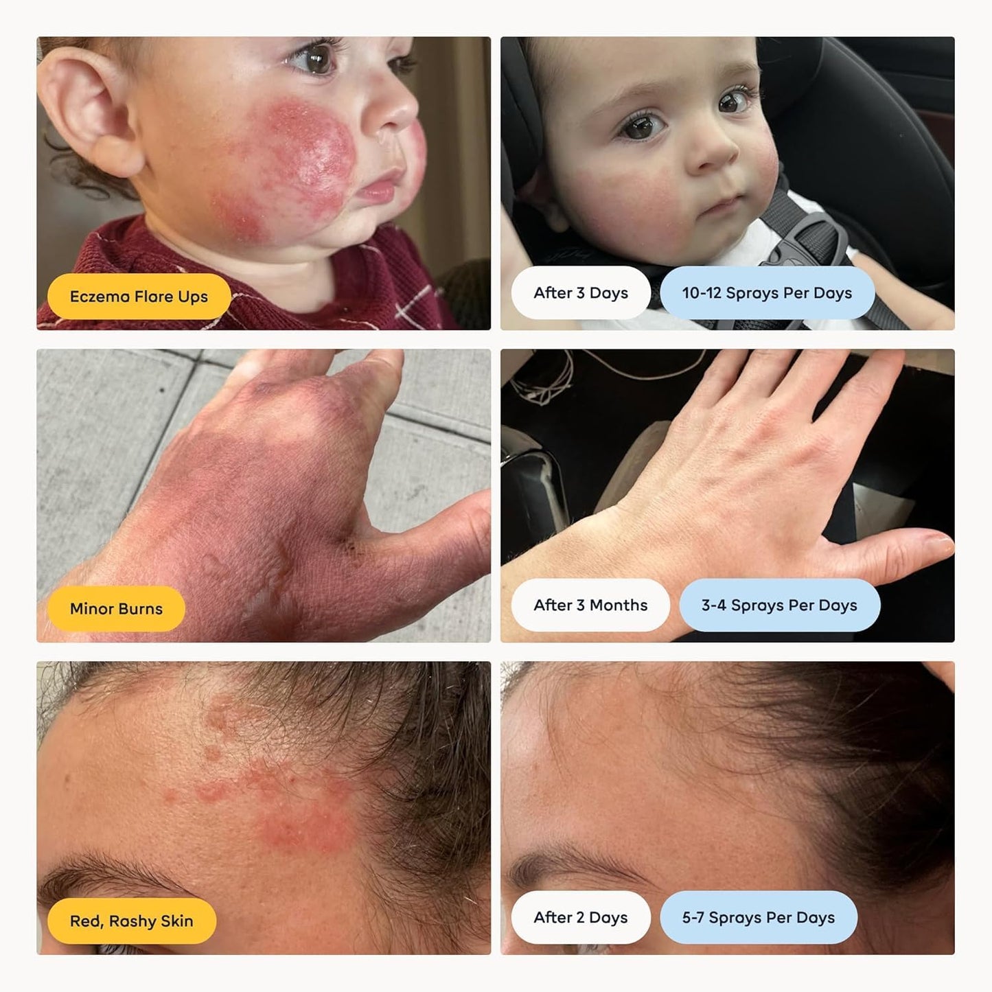 Magic Molecule Hypochlorous Acid Facial Mist – Soothes Redness & Irritation, Cleanses & Purifies – Home & Travel Bundle (8oz + 2x3.4oz)