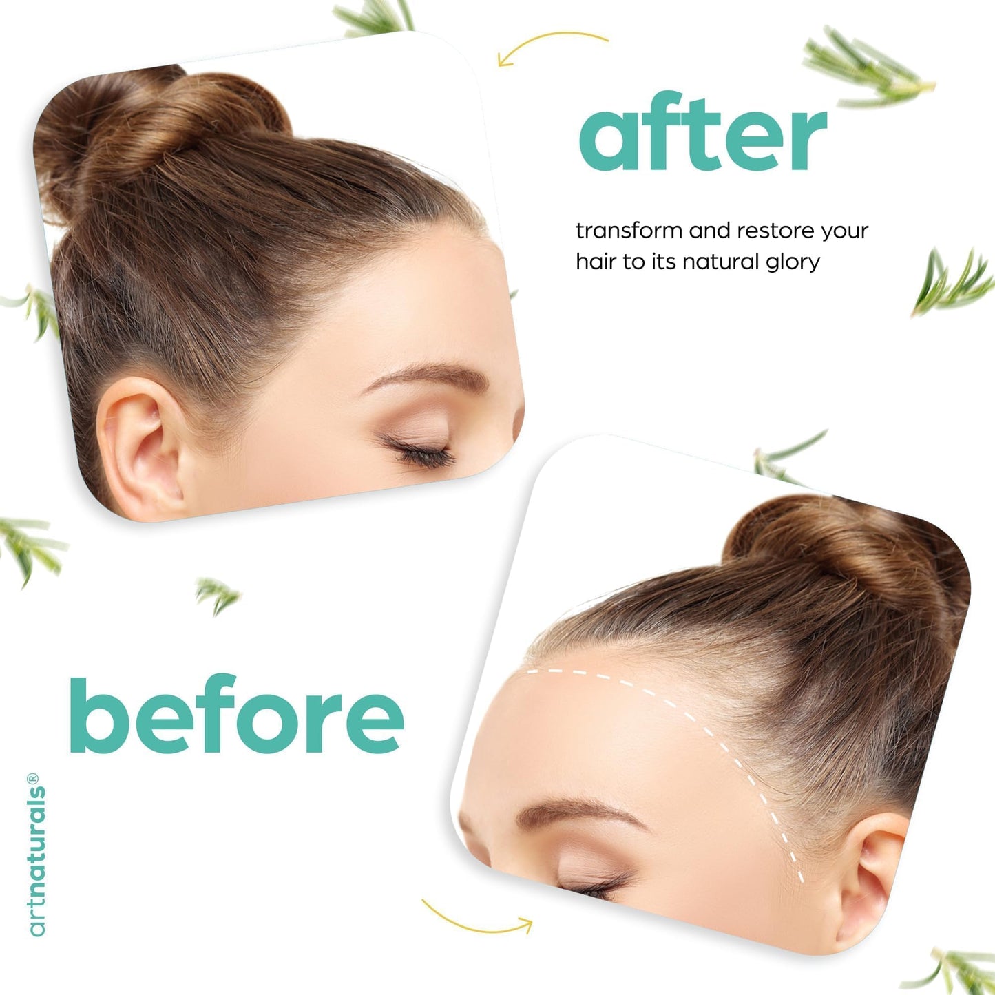 ArtNaturals Rosemary & Castor Hair Growth Oil + Scalp Massager Set | Hydrating Scalp Treatment for Dry, Itchy, Damaged Hair & Split Ends – 4 oz