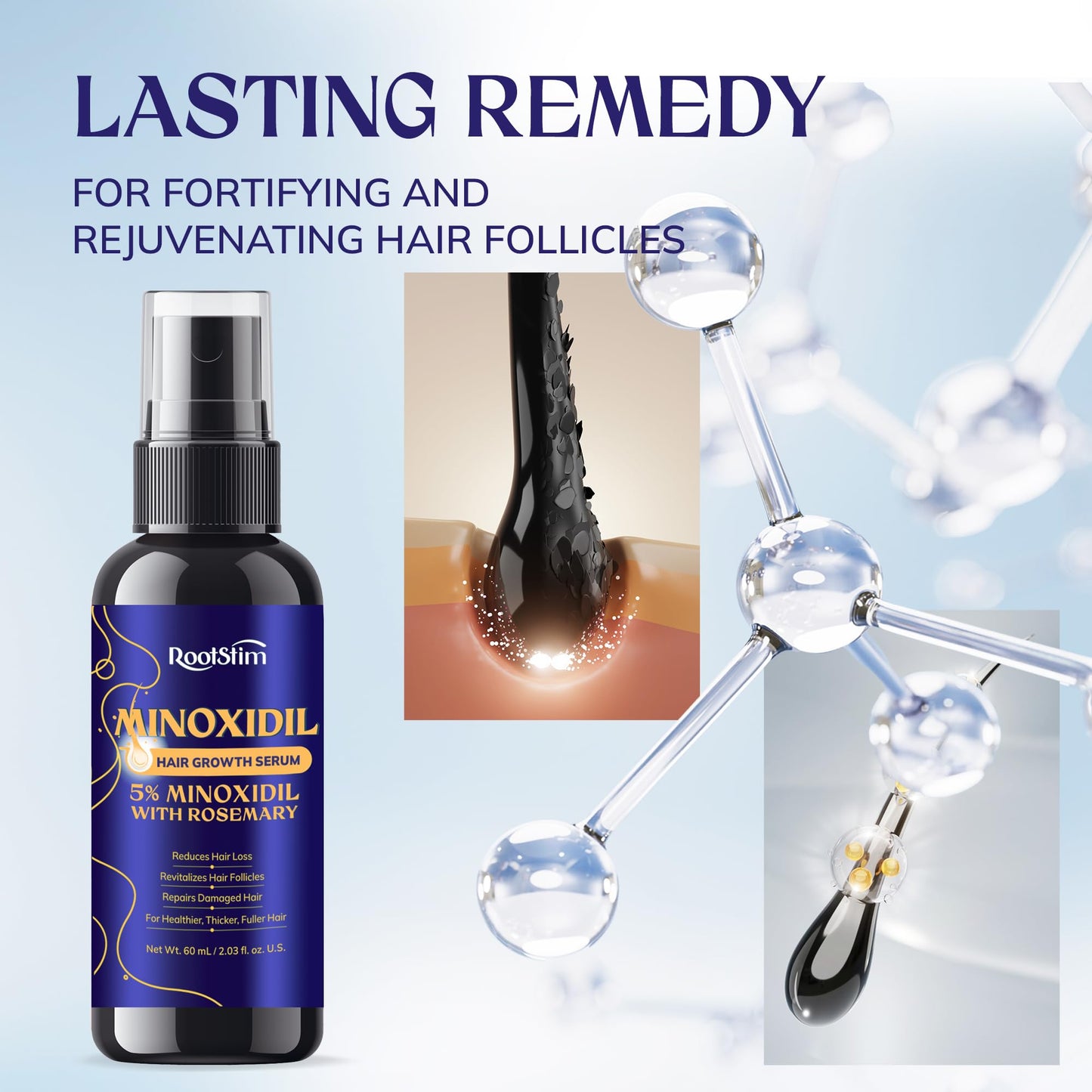 5% Minoxidil Hair Growth Serum for Men & Women – Extra Strength Hair Loss Treatment with Rosemary for Thicker, Stronger, Faster Hair Growth, 60ML