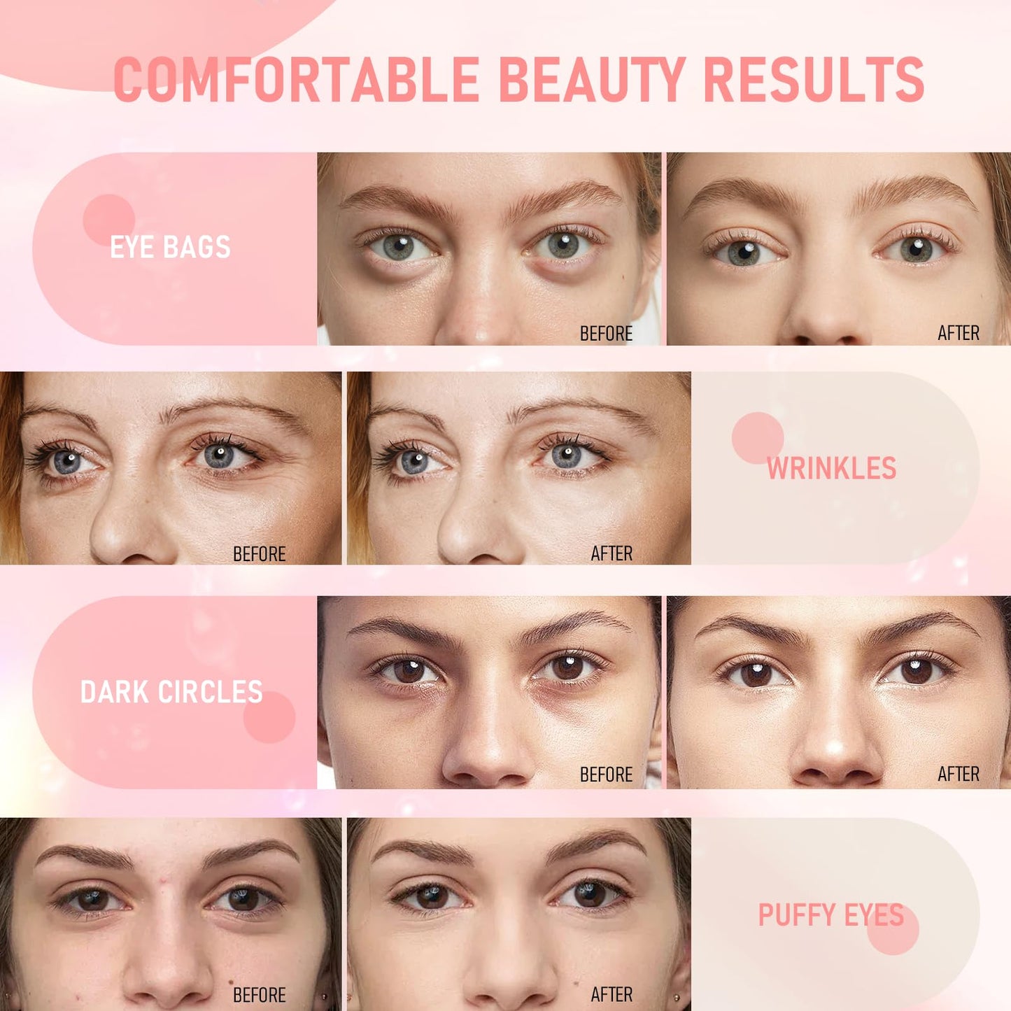 30 Pairs Rose Eye Masks - Under Eye Patches for Dark Circles, Puffiness, Wrinkles & Fine Lines, Skincare for Women & Men