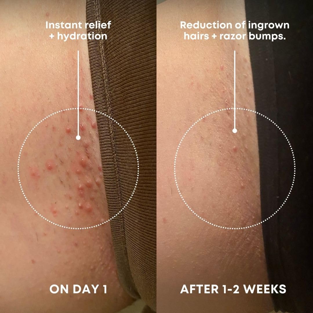 Bushbalm Ingrown Hair Exfoliating Scrub – Pre-Shave Sugar Scrub for Razor Bumps, Dry & Sensitive Skin, Soothing Buffing Treatment, 236ml