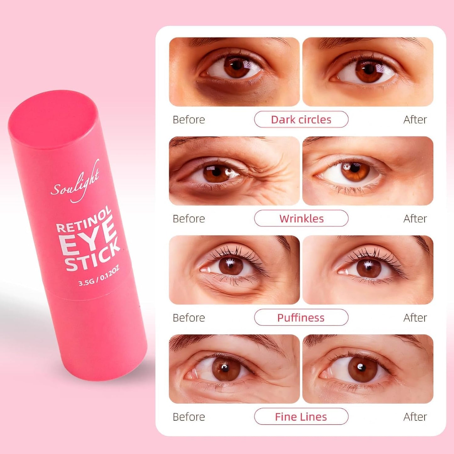 Soulight Retinol Eye Stick - Anti-Aging Eye Balm for Wrinkles, Dark Circles & Puffiness, Moisturizing Eye Cream to Soften & Nourish Skin