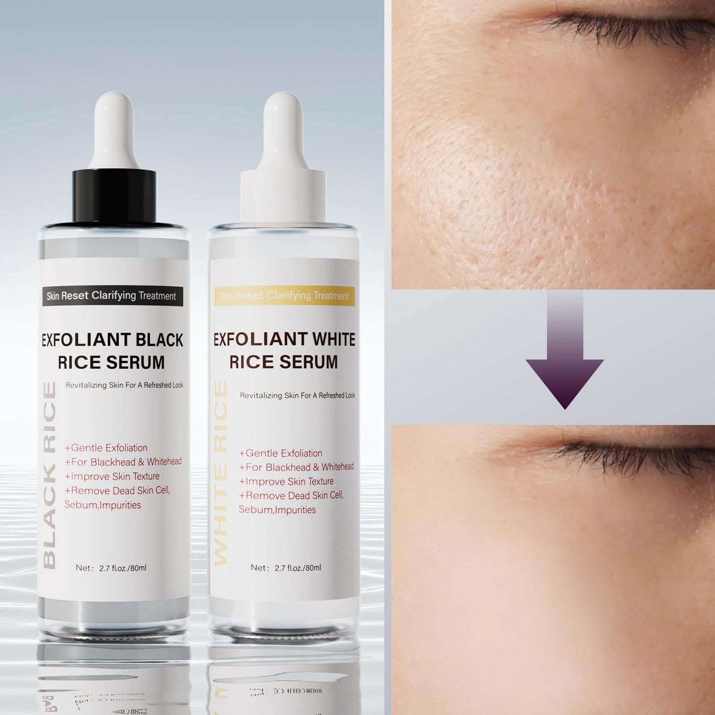 Duo Soft Black Rice Peel Exfoliating Ampoule – Gentle Face & Body Serum for Dead Skin, Deep Cleansing, Pore Minimizing & Hydration