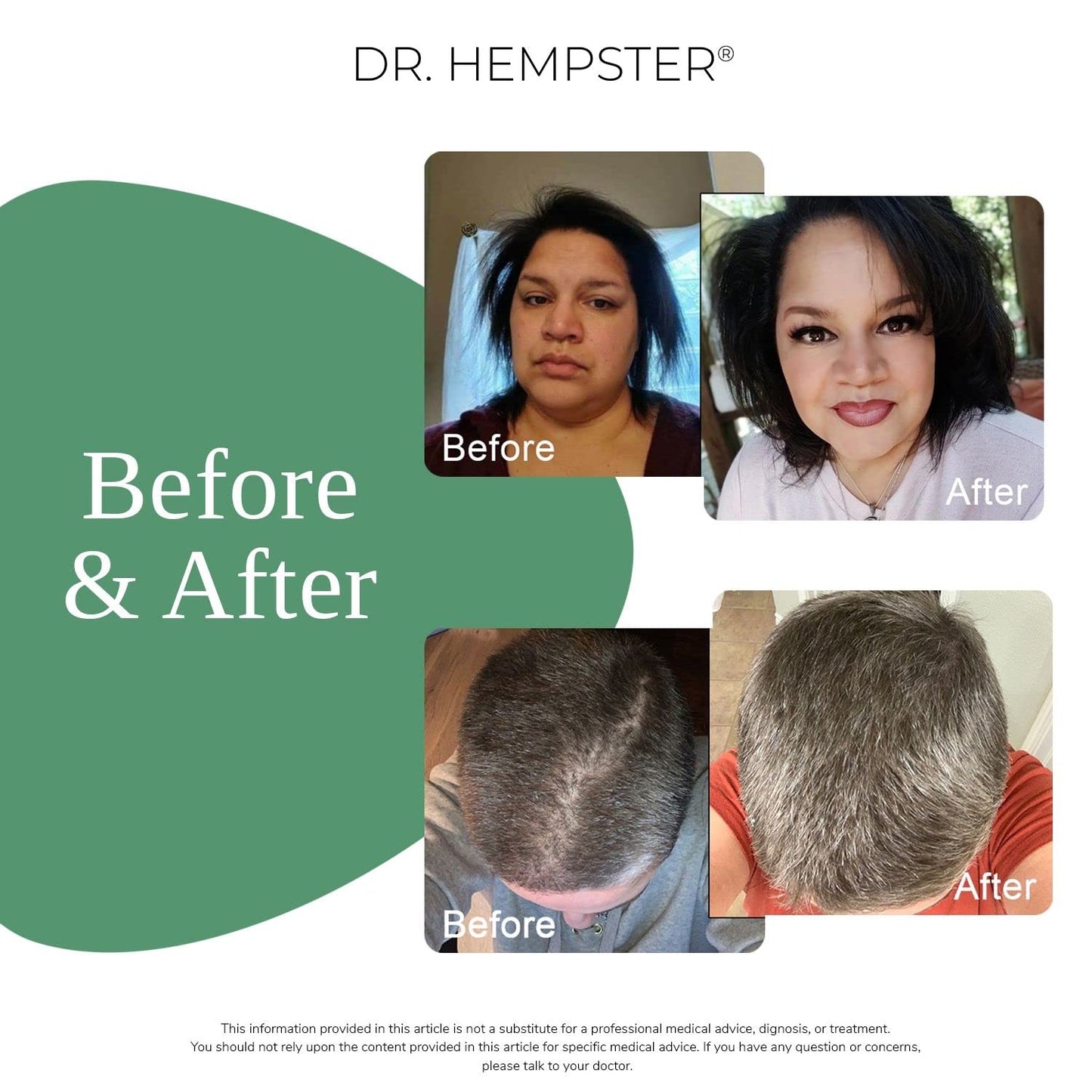 Biotin Hair Loss & Thinning Treatment for Men & Women - Hair Growth Shampoo for Regrowth