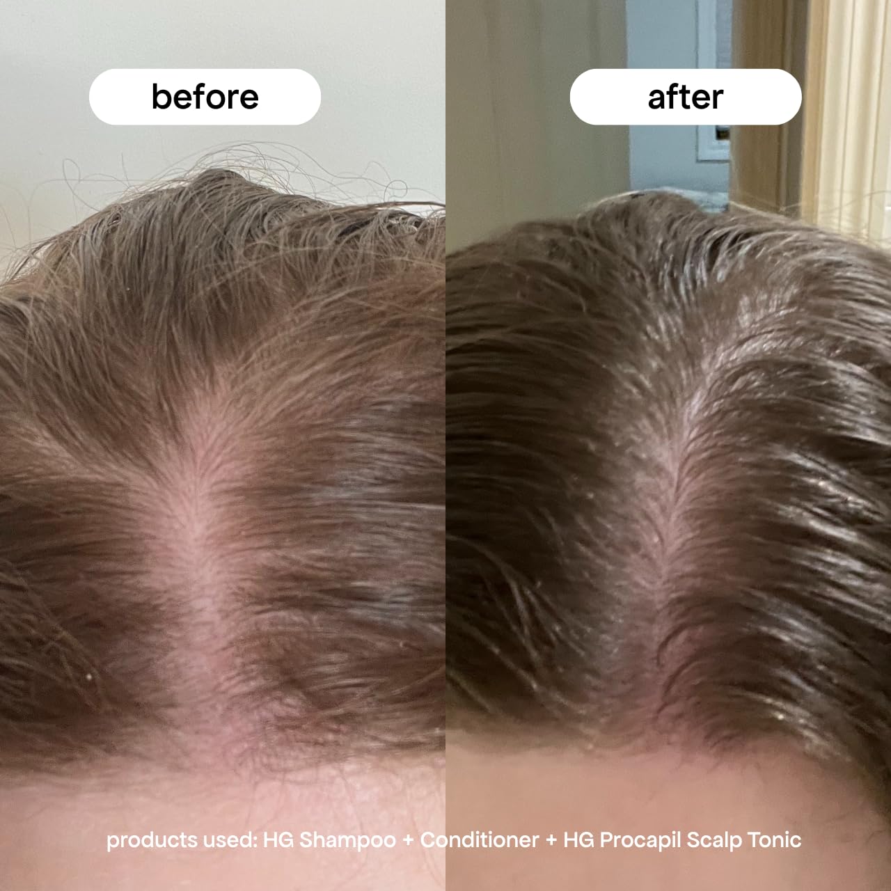 BONDIBOOST Procapil Scalp Treatment 4.23 fl oz – Daily Leave-In Serum for Thinning Hair, Thicker Hair with Procapil, Biotin & Rosemary, Sulfate-Free