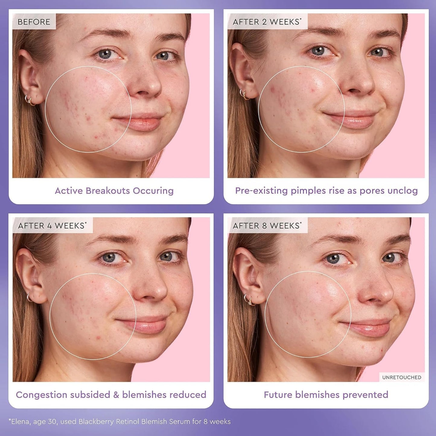 Glow Recipe Glass Skin Travel Skincare Set – Mini Toner, Strawberry Blur Drops, Retinol Serum & Pink Juice Moisturizer, 4-Piece Kit