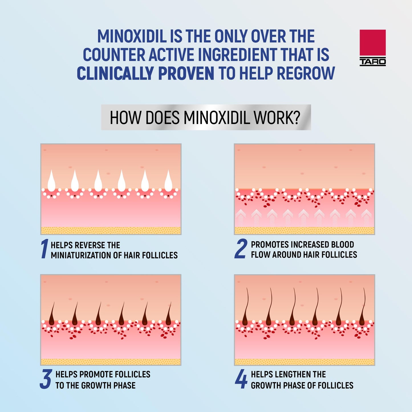 Taro Minoxidil for Men, 2.11 Oz (1 Month Supply) Clinically Proven to Regrow Hair, Topical Aerosol Foam 5%, Hair Thinning Treatment