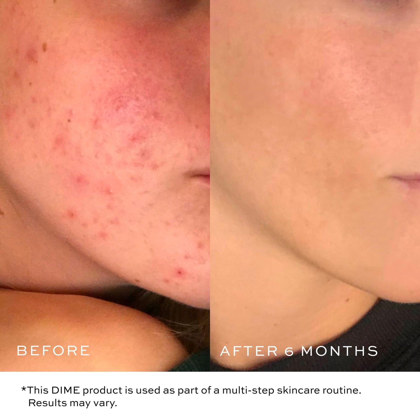 DIME Beauty Gentle Jelly Cleanser, Hydrating Facial Cleanser and Makeup Remover with Vitamin E, Face Wash for Sensitive Skin, 4 oz (120 ml)