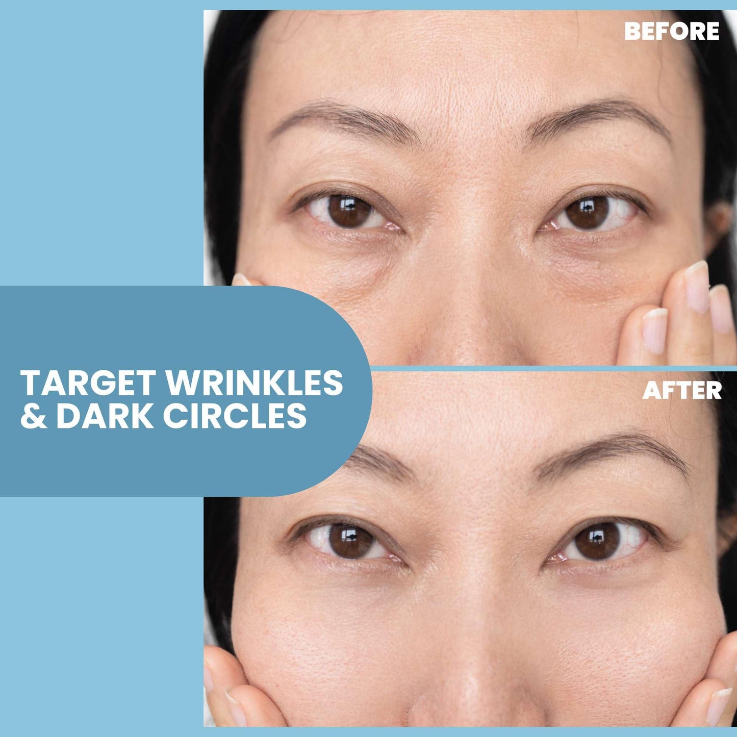 Eva Naturals Eye Gel – Anti-Aging Under Eye Treatment with Peptides, Hyaluronic Acid & Botanicals for Dark Circles, Puffiness & Wrinkles, 2 oz