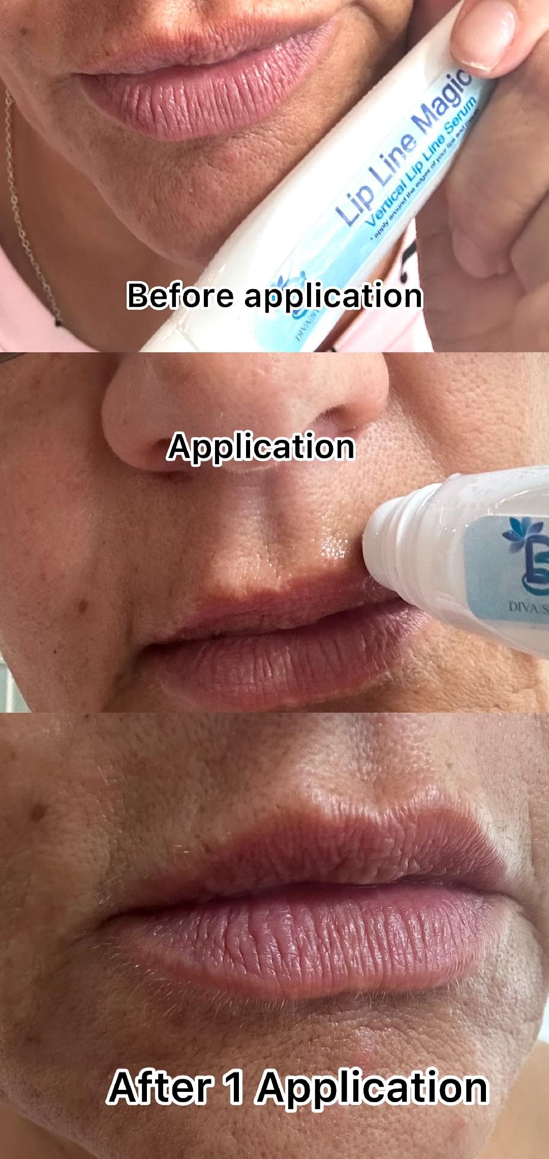 Lip Line Serum For Lines Above the Lips, Max Strength, With Hyaluronic Acid, Papaya Extract and Retinol