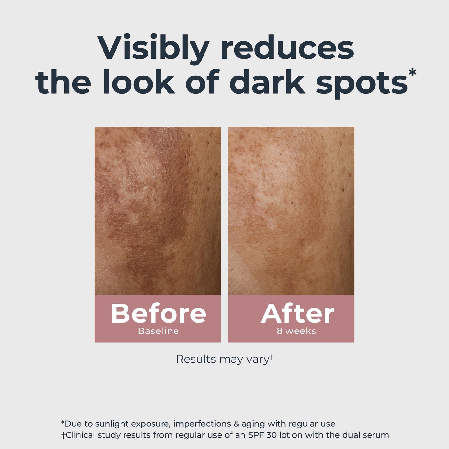 Eucerin Radiant Tone Dual Serum – Dark Spot Corrector with Thiamidol & Hyaluronic Acid, Reduces Persistent Dark Spots, 1 fl. oz.