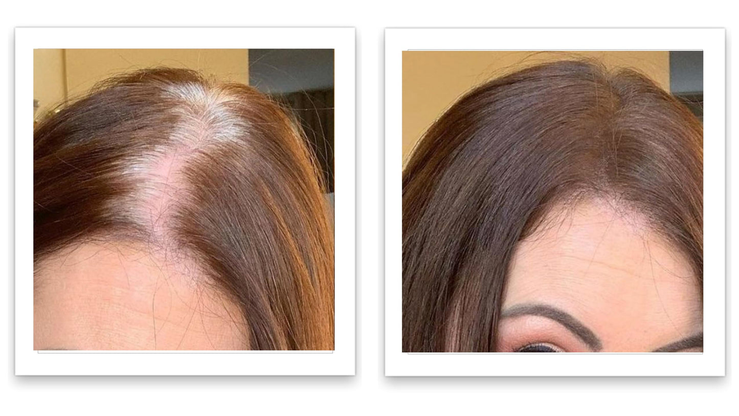 Caboki 10X Volumizing Hair Powder for Thinning Hair: Root Touch Up for Men and Women, Fill in Hairline & Edges, Cover Bald Spots. TALC-Free, Dark Gray