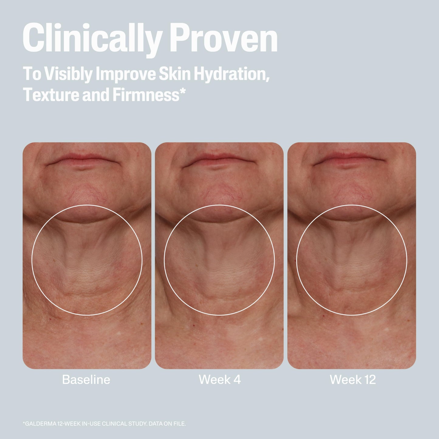 Cetaphil Skin Activator Hydrating & Firming Body Cream 12oz with Mandelic Acid & Centella Asiatica, Anti-Aging, Hydrates & Firms Skin