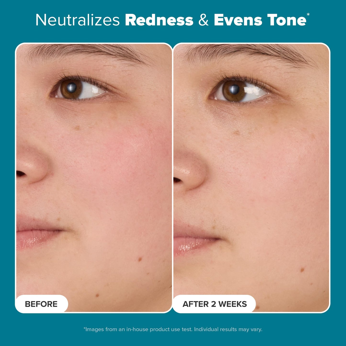 Paula's Choice SKIN BALANCING Pore-Reducing Toner with Niacinamide for Oily & Combination Skin, Minimizes Pores, Controls Oil & Hydrates, 6.4 oz