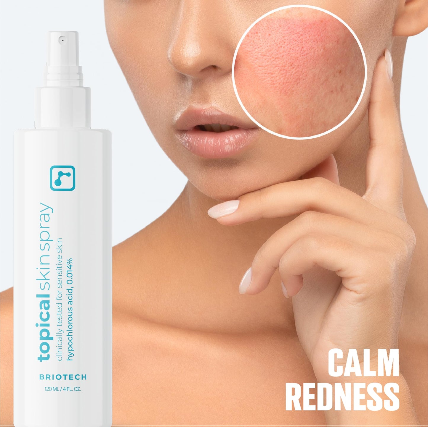 BRIOTECH Hypochlorous Acid Skin Spray – Soothes Redness, Irritation & Sensitive Skin, Facial & Full Body Mist, Foot & Scalp Relief, 8 oz