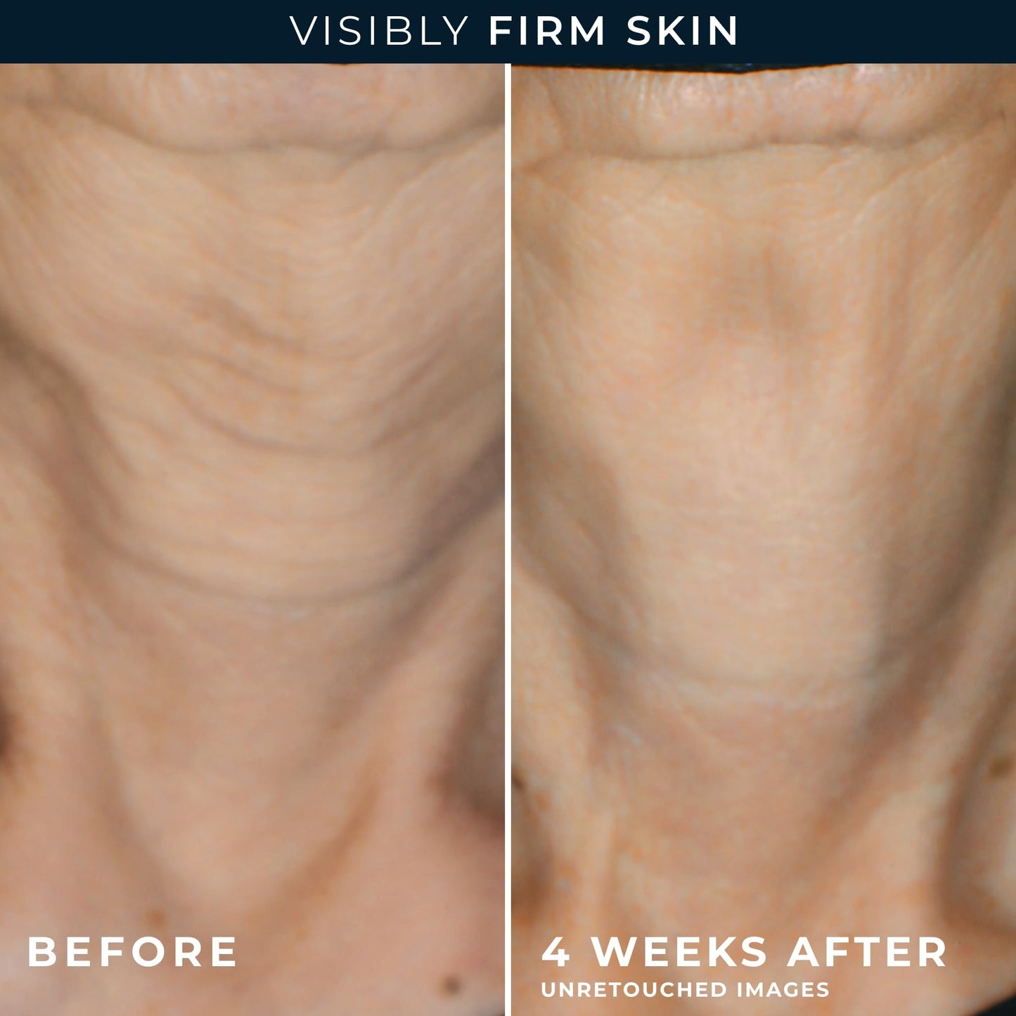 RoC Crepe Repair Daily Face & Neck Moisturizer 1.7oz + Retinol Wrinkle Smoothing Capsules 7ct – Anti-Aging Skincare for Men & Women