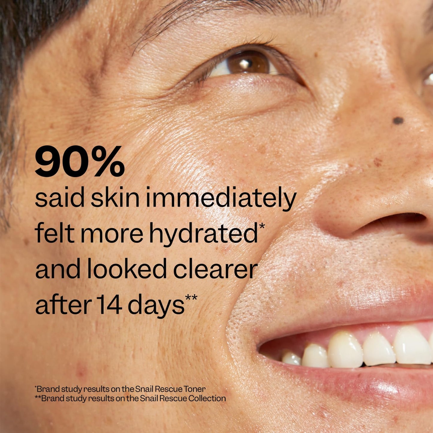 Peach Slices Snail Rescue Blemish Toner – 95% Snail Mucin, Pore Cleansing, Hydrating & Balancing, CICA, Hyaluronic Acid, 4.05 oz